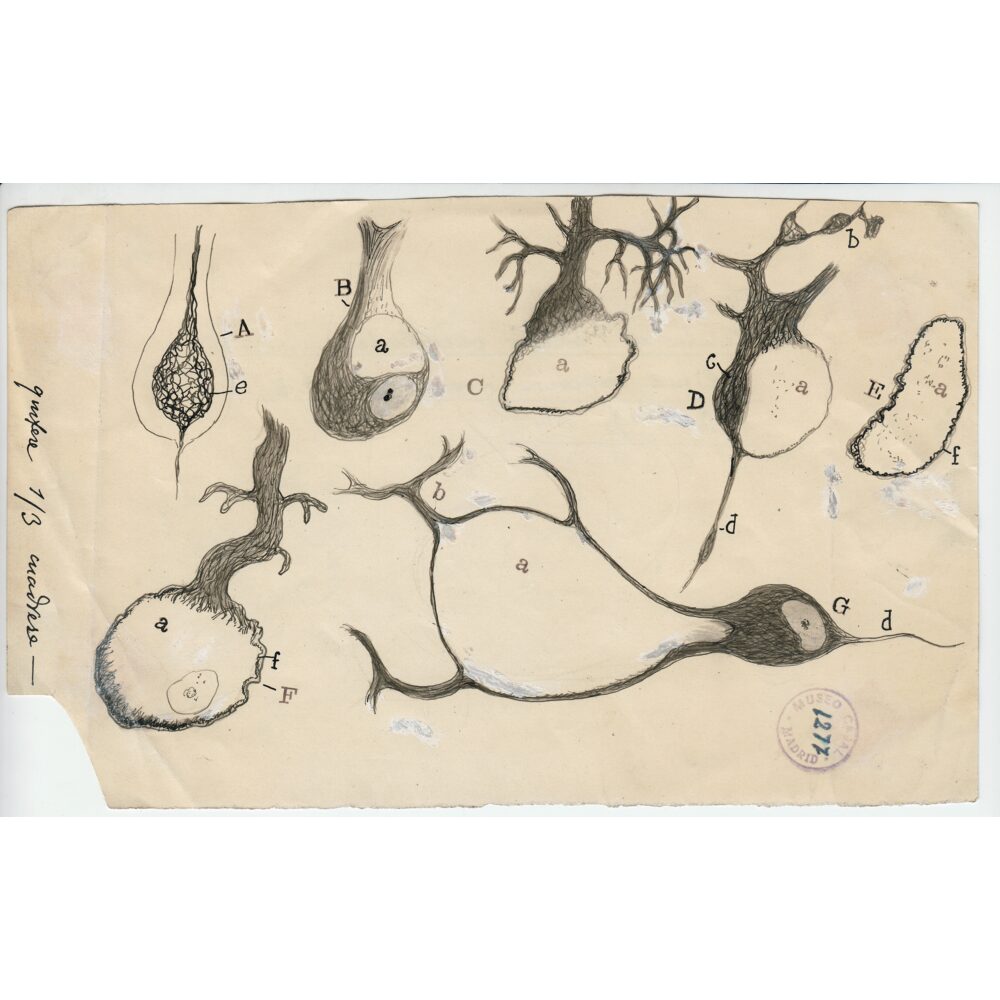 Ink illustration depicting various forms of damaged Purkinje neurons with branched dendrites on a light background. (Alt-text generated by AI)