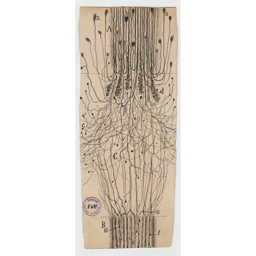 Vertical scientific diagram detailing nerve fibers severed and regenerating across a central junction line. (Alt-text generated by AI)